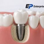 Implant Newcastle